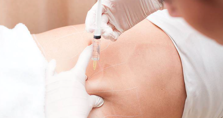 fat dissolving injection