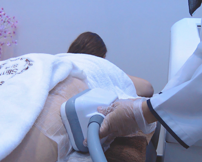 cooltech fat freezing